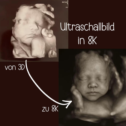 Ultraschall Babybild in 8K | Fotorealistische KI-Verwandlung | Erstes Babyfoto | Digitaler Download | Jungen & Mädchen kleinebuchstaben