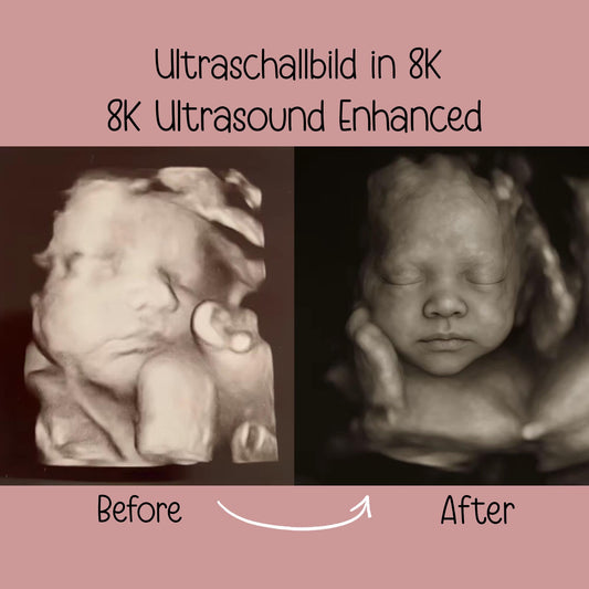Ultraschall Babybild in 8K | Fotorealistische KI-Verwandlung | Erstes Babyfoto | Digitaler Download | Jungen & Mädchen kleinebuchstaben